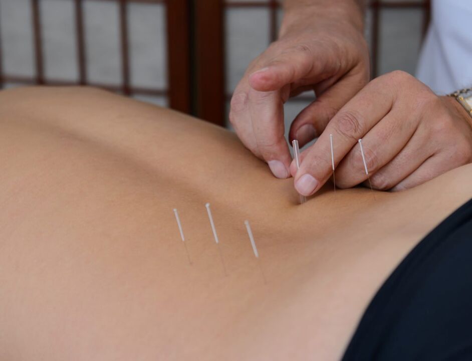 akupunktur för prostatit