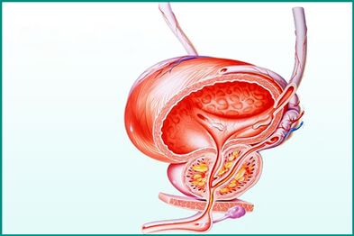 Inflammation i prostata vid akut prostatit är en begränsning för sex