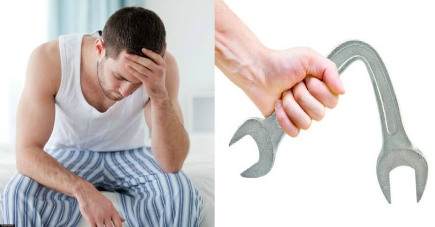 Symtom på prostatit
