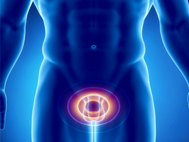 Prostatit – inflammation i prostatakörteln hos en man